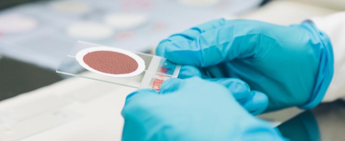 phd mariene microbiële interacties