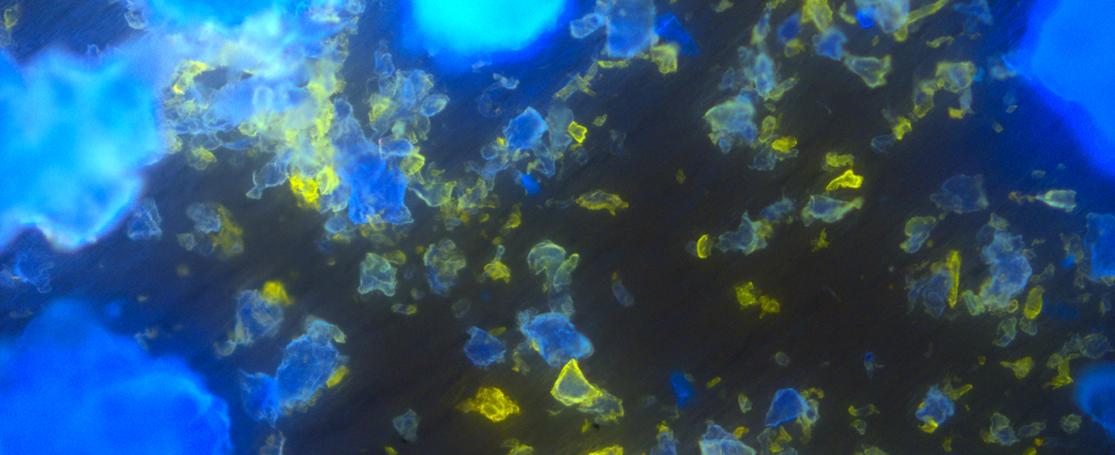 Microplastics fluorescentiemicroscoop