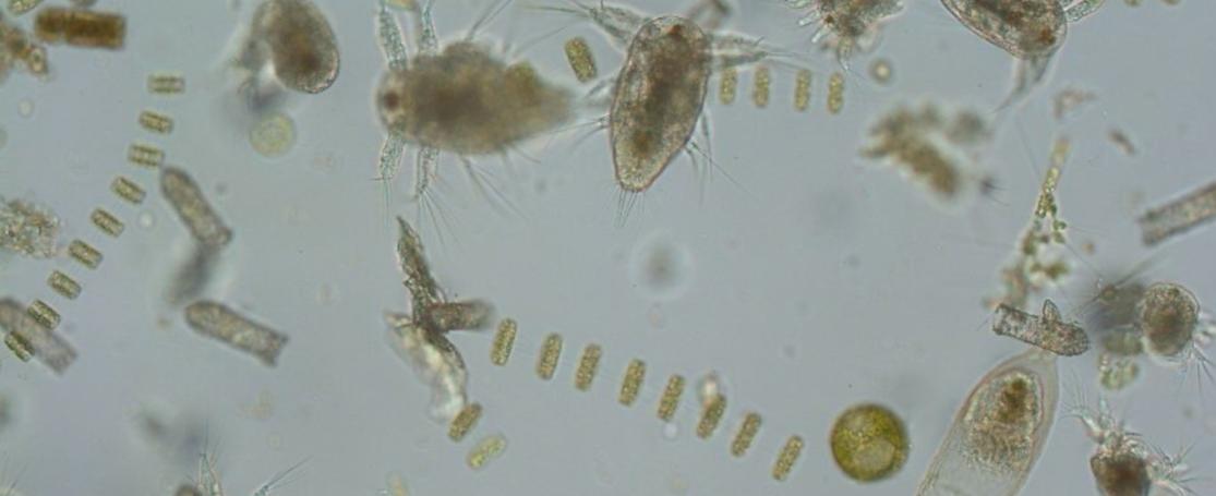 Plankton door de microscoop